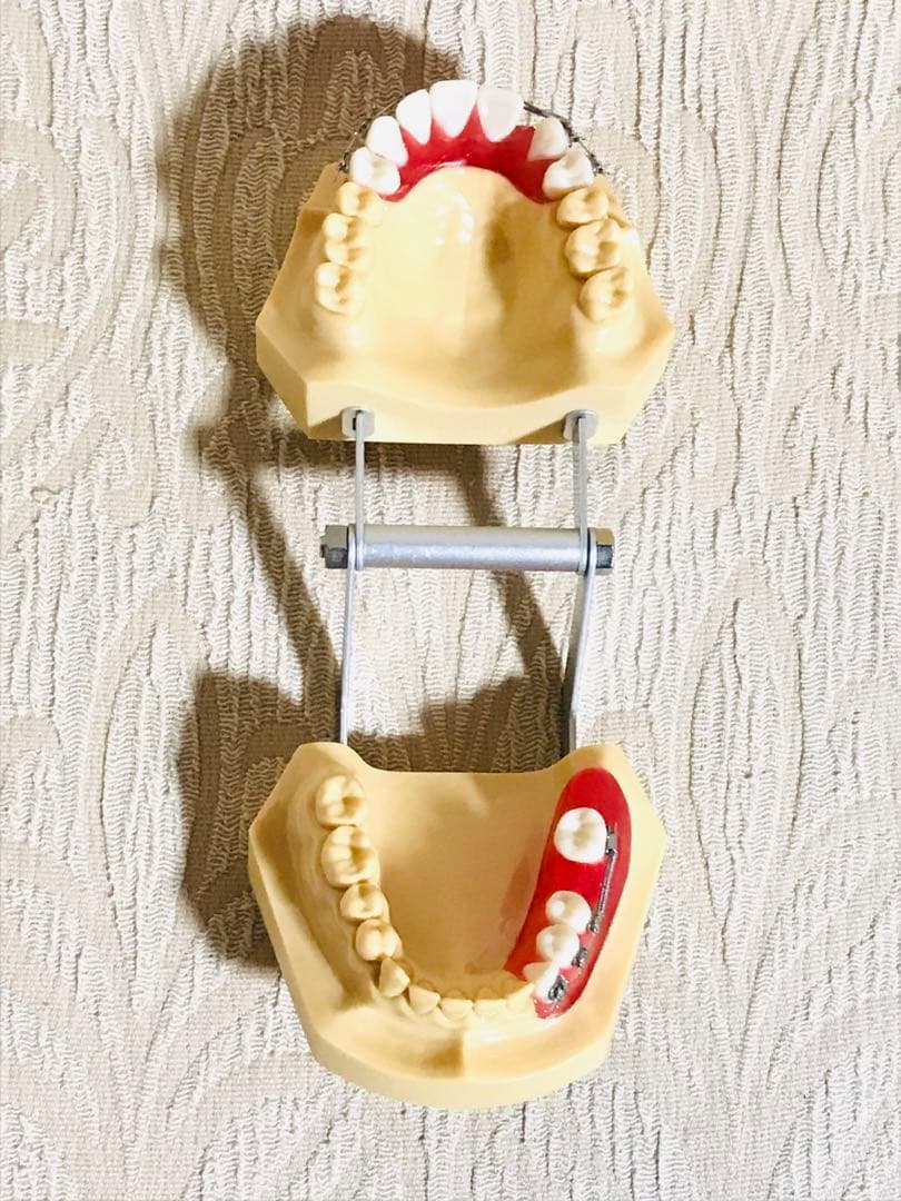 NISSIN DENTAL STUDY MODEL 矯正  歯　模型