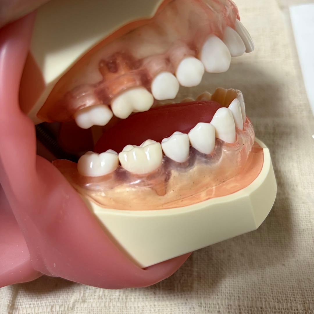 顎模型 頬粘膜付き 箱無し