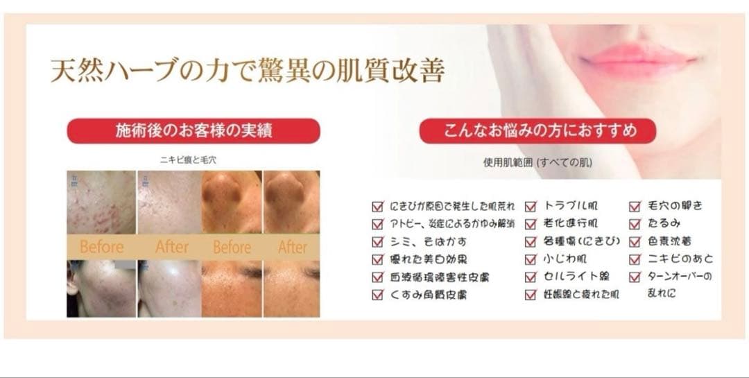 O.H.L ハーブピーリングキット　韓国ハーブ