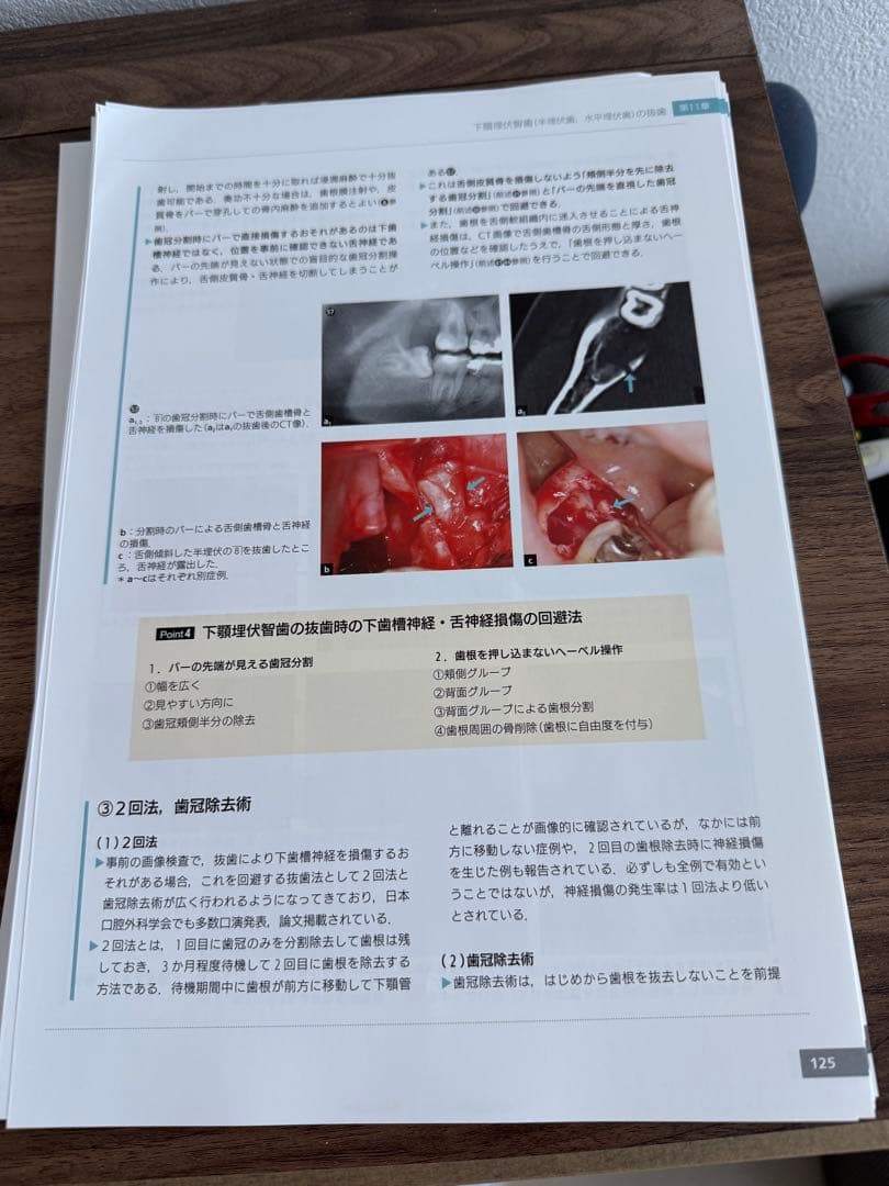 必ず上達 抜歯手技 増補新版　裁断済み