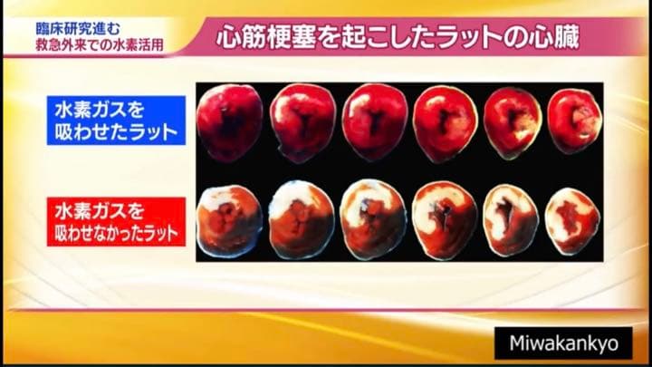 【値下げ】ウイルス対策に必見！H2マルチポッド(水素吸入器・生成器)