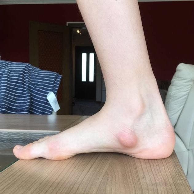 SK8INSOLL® DOUBLE AXEL カスタマイズインソール サイズXS