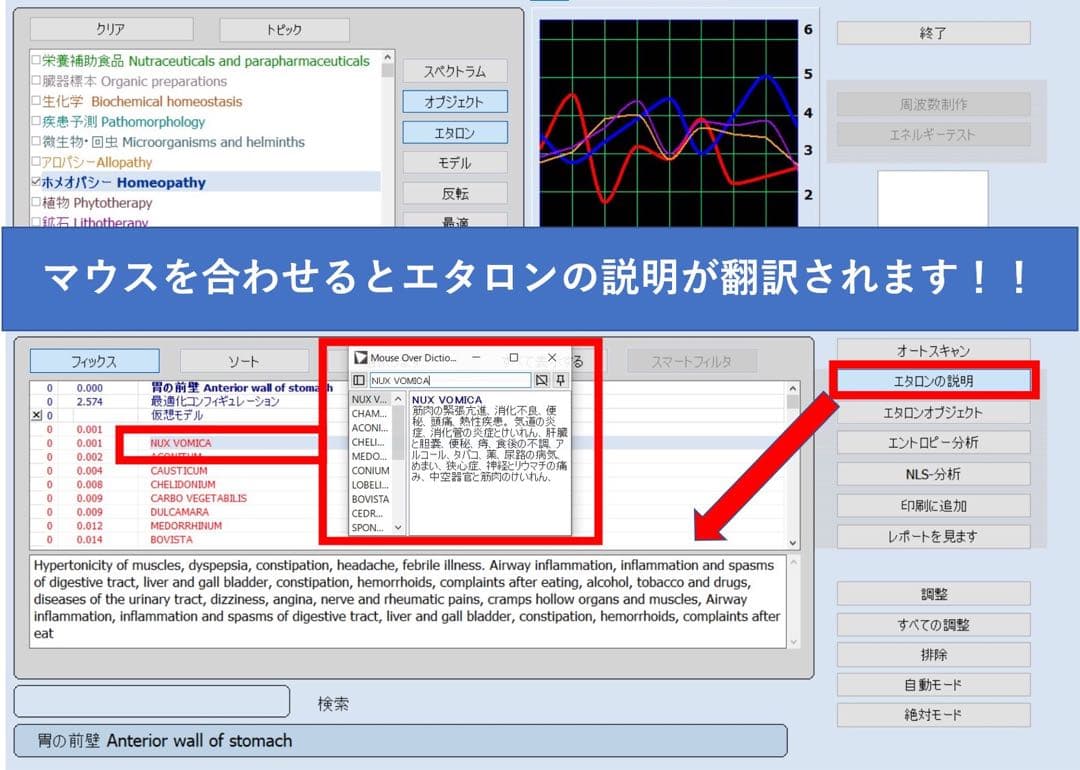 1年保証　PC付　波動測定器　波動　バイオレゾナンス　ニュースキャン類似商品