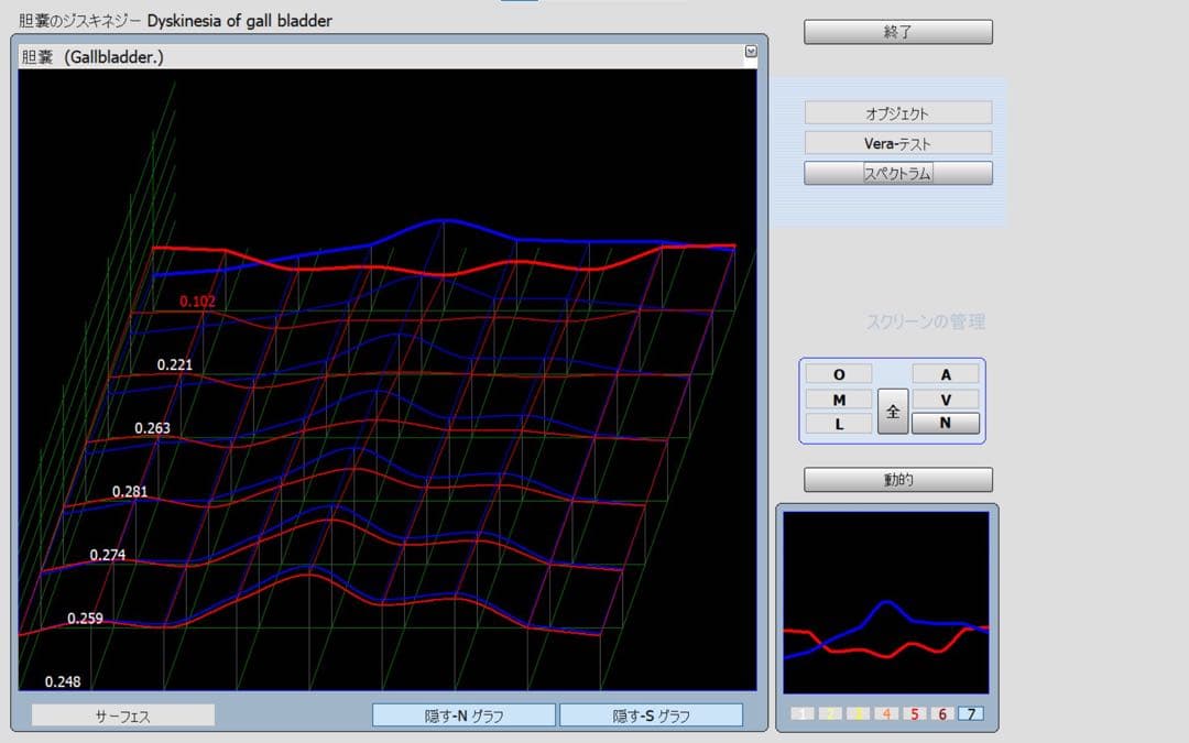 1年保証　PC付　波動測定器　波動　バイオレゾナンス　ニュースキャン類似商品