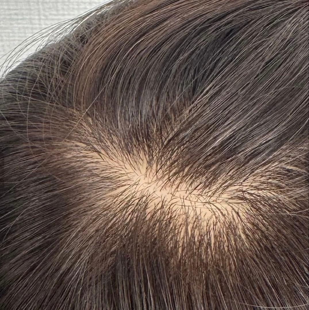 百合子ウィッグ　 ネオピース15×17